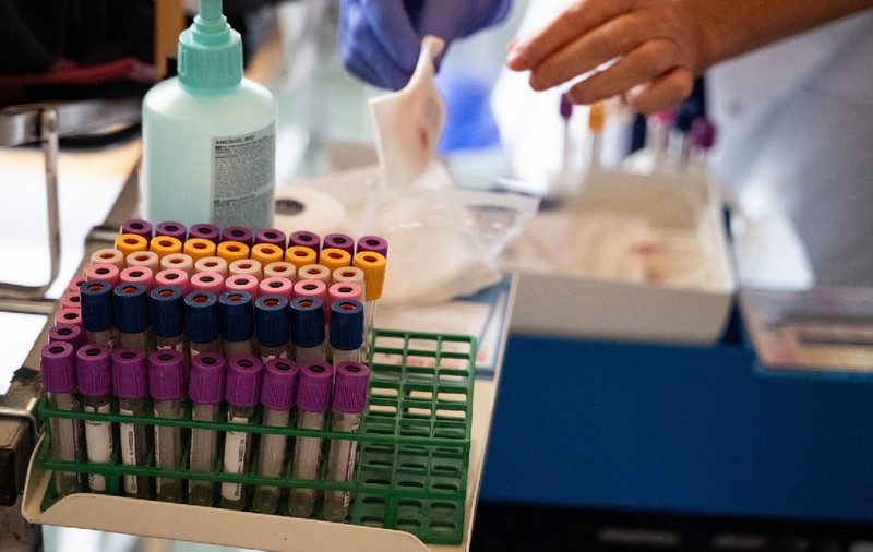 Testul de sânge revoluționar care detectează cancerul cu câțiva ani înainte ca simptomele să apară