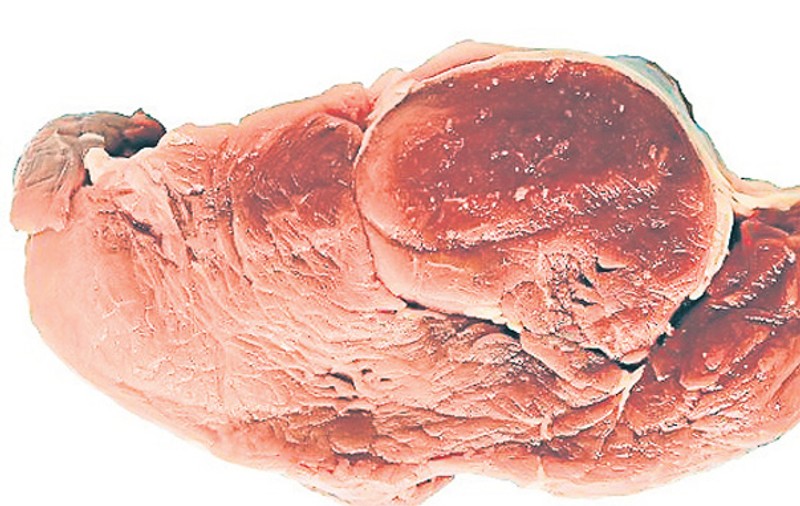 Totul despre carnea de porc