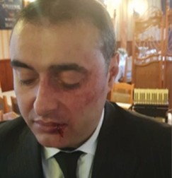 Marian Mexicanu‘, bătut crunt de mai mulți bărbați.