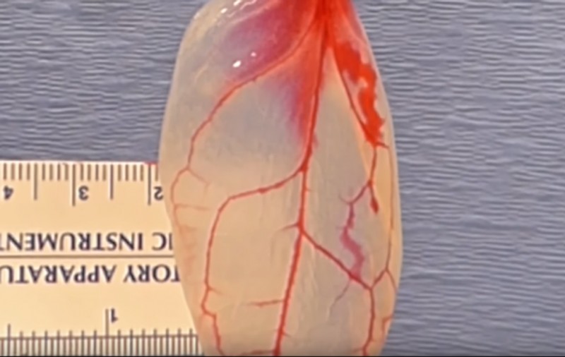 Descoperire majoră: o frunză de spanac, folosită drept țesut cardiac