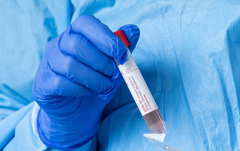 Intrarea pe teritoriul Irlandei se va face cu un test negativ la COVID-19