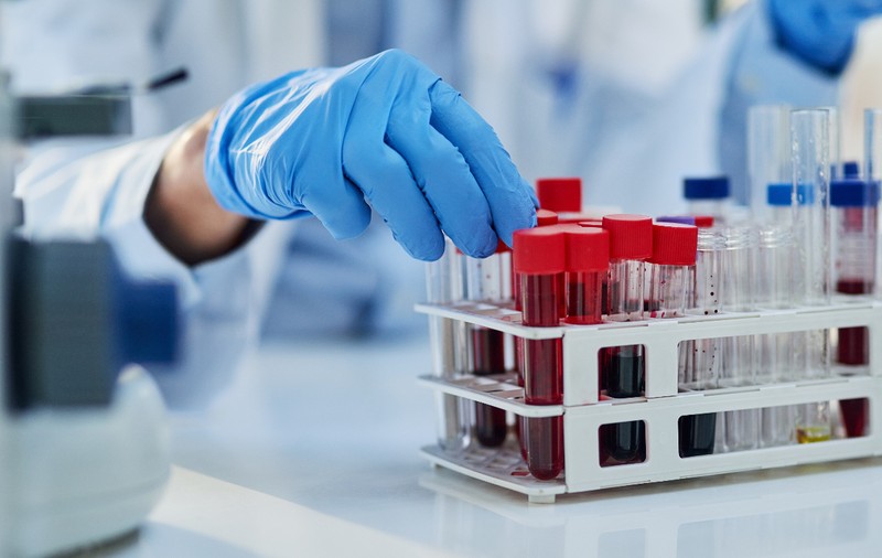 Primul test de sânge pentru diagnosticarea sindromului oboselii cronice, dezvoltat în Marea Britanie