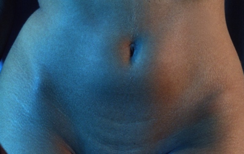 Anticorp care poate lupta împotriva cancerului ovarian, descoperit la Viena