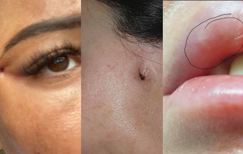 Mărturiile clientelor desfigurate de „Dr.Lana”, cosmeticiana care pretindea că e medic estetician. „M-a făcut praf”