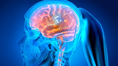 X-,Ray,Female,Head,With,Microchip,Implant,-,3d,Illustration