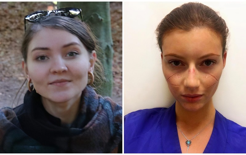 „Modelul suedez” de combatere a pandemiei, trăit de două studente în cel mai mare focar COVID din țară: „Nu există nicio obligație, doar recomandări”