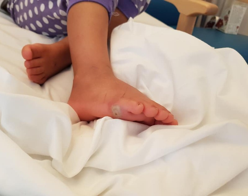 FOTO | O fetiță a făcut septicemie de la o bacterie pe care a luat-o probând o pereche de pantofi