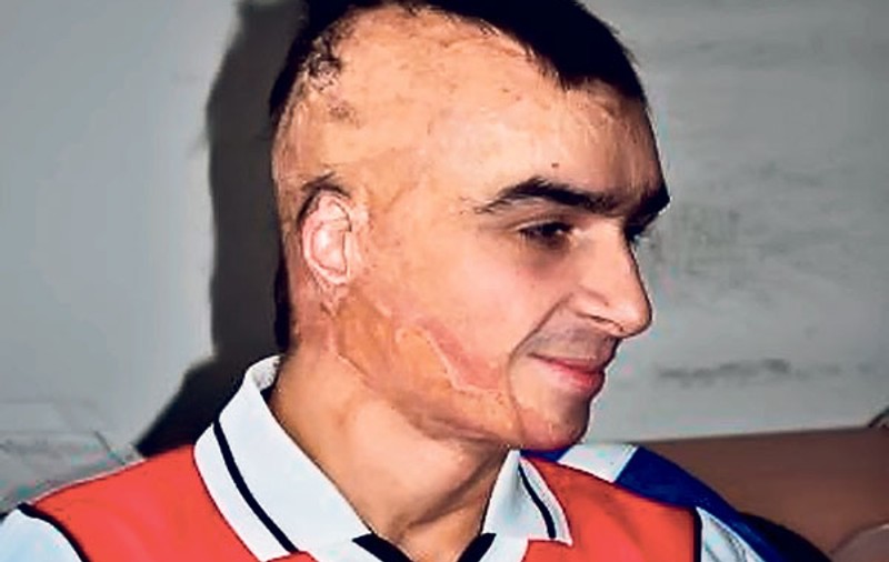 Părinţi de coşmar! Mama lui i-a furat banii de operaţie!
