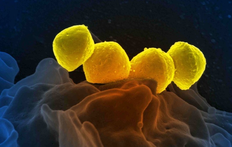 O bacterie carnivoră rară care provoacă moartea în 48 de ore se răspândește în Japonia