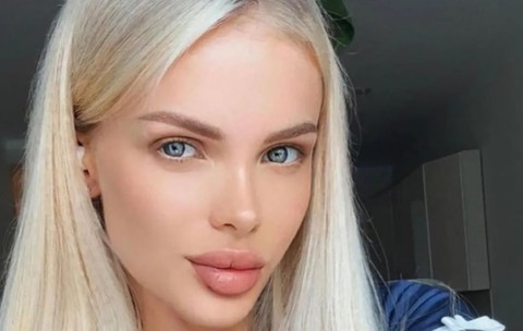 Fotomodelul Angelica și-a pierdut jumătate din craniu după ce a fost bătută de iubitul ei, un om de afaceri rus: „Oligarhul a făcut infarct de frica mobilizării pentru război”