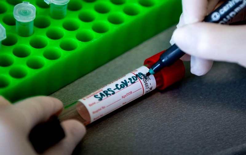 O fetiţă de 12 ani a murit din cauza noului coronavirus în Belgia