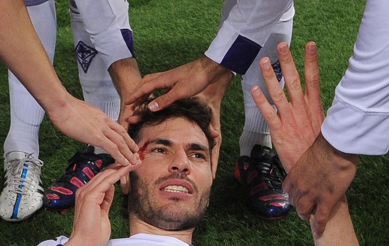 Accidentare stupidă pe Olimpico! Basanta a dat gol, iar un coechipier i-a spart arcada / GALERIE FOTO
