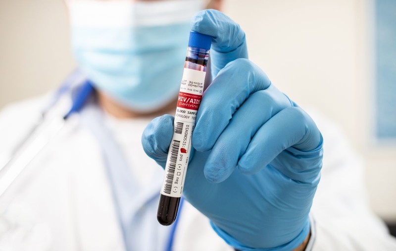 Epidemia COVID îi lasă pe bolnavii de HIV fără tratament. Zeci de țări au avertizat OMS că au un stoc scăzut de antiretrovirale, vitale pentru pacienți