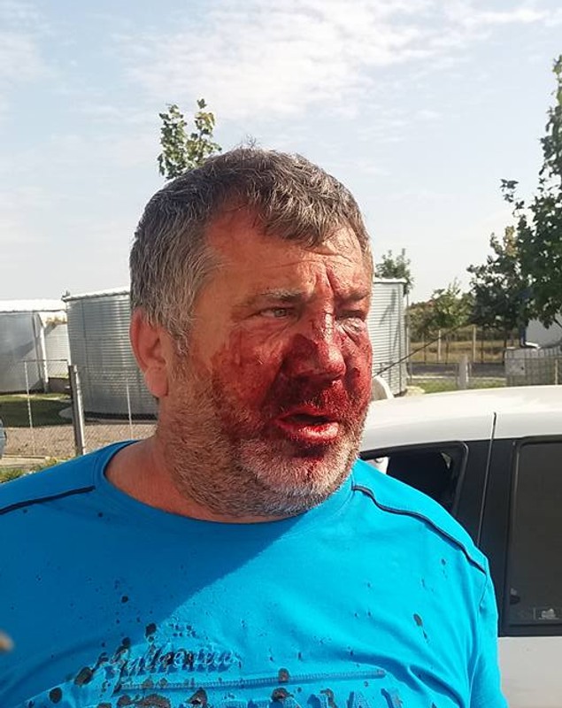 Un antrenor a fost umplut de sânge de rudele unui fotbalist. Imagini horror