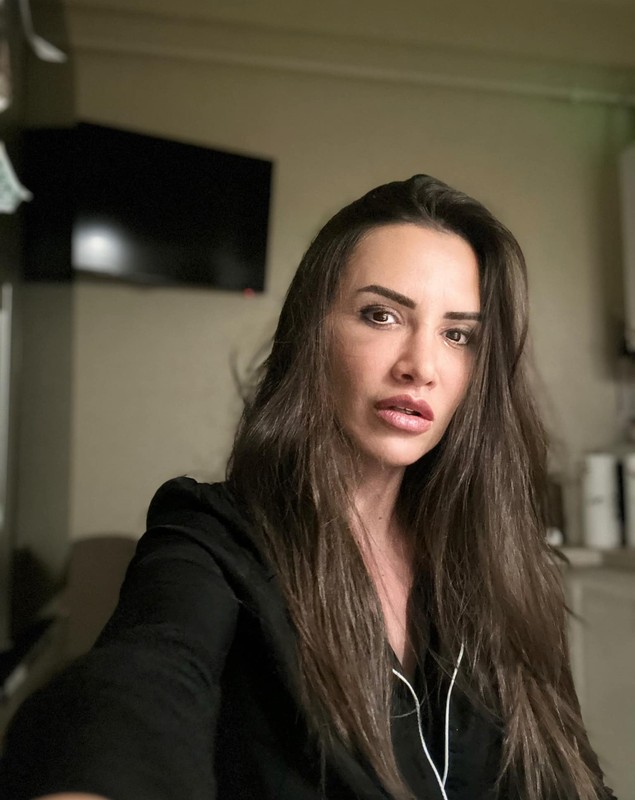 Cum arată Mara Bănică după operația estetică la față, care a costat 15.000 de euro. Fanii au criticat-o: „Nu mai ești tu, nu îți stă bine”