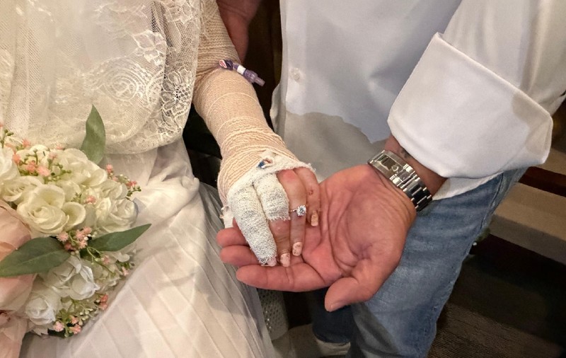 Un spital din Florida a organizat nunta unei paciente cu arsuri grave suferite într-un accident la grătar