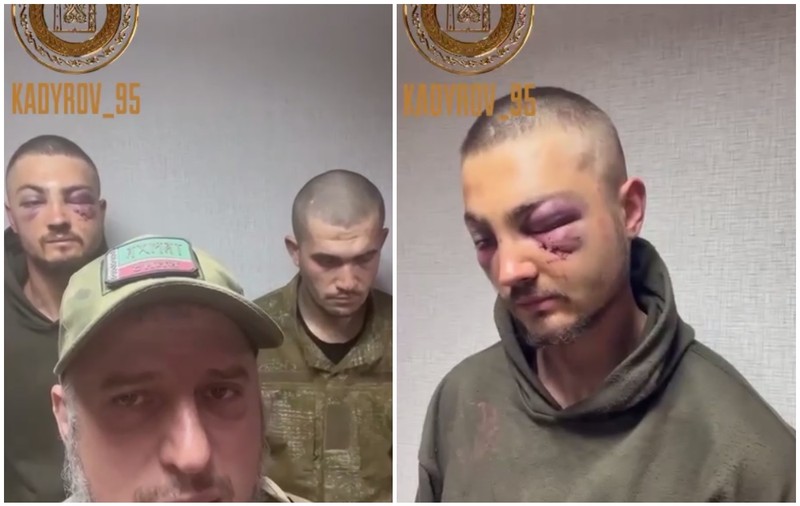 Soldat ucrainean capturat de cecenii lui Kadîrov, cu ochii învinețiți: „A călcat pe o greblă când se preda!”