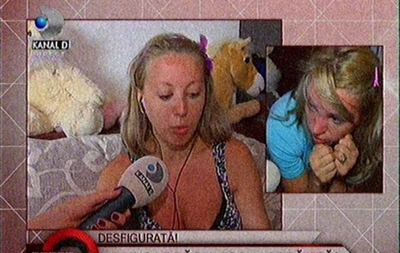 Larisa Dragulescu, desfigurată. ”De o lună sunt blestemată”