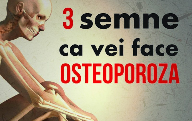 Semne că vei face osteoporoză