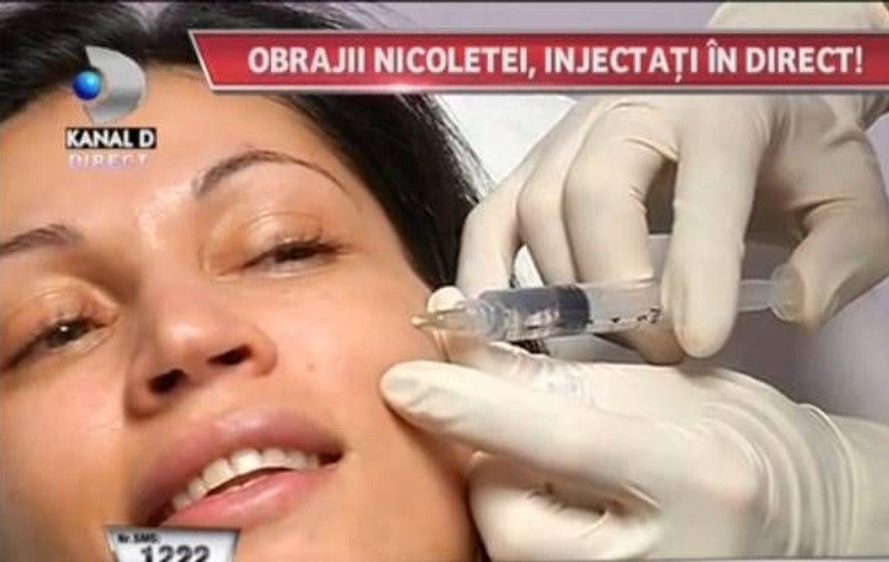 WOW, ce ÎNDURĂ Nicoleta Luciu ca să fie frumoasă! Vedeta și-a făcut injecții în față, în direct, la TV. Cum ți se pare gestul ei? | FOTO