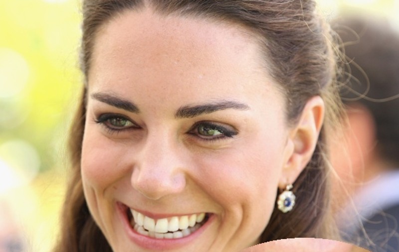 Un dentist francez i-a strâmbat dinţii lui Kate Middleton. Află de ce!