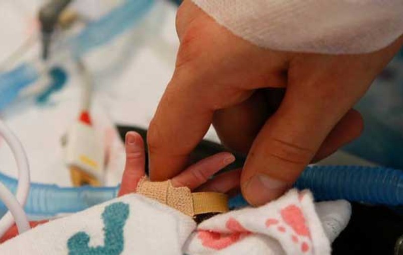 IMAGINEA CARE A CUCERIT INTERNETUL! Gemenele care S-AU NĂSCUT ŢINÂNDU-SE DE MÂNĂ | FOTO