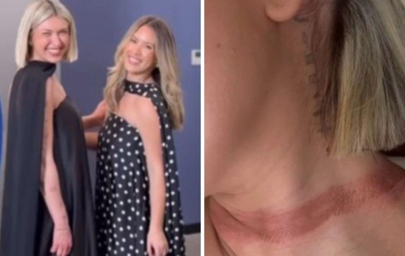 O influenceriță a fost „aproape decapitată” după ce eșarfa de mătase i s-a prins în mașină