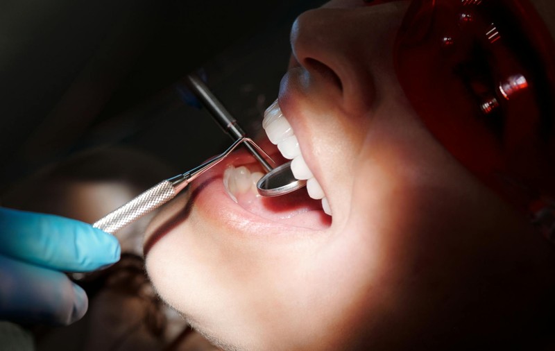 Etapele procedurii de implant dentar – ce trebuie să știi