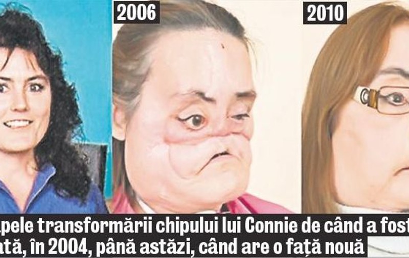 Femeia care a făcut transplant total de faţă s-a întâlnit cu fiica donatoarei: "Îţi stă bine cu faţa mamei!"