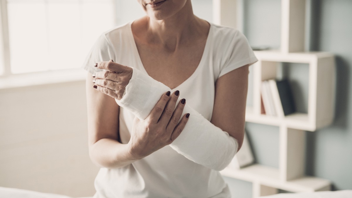 Cum este corect: gips sau ghips - Imagine cu o femeie care are mâna în ghips.