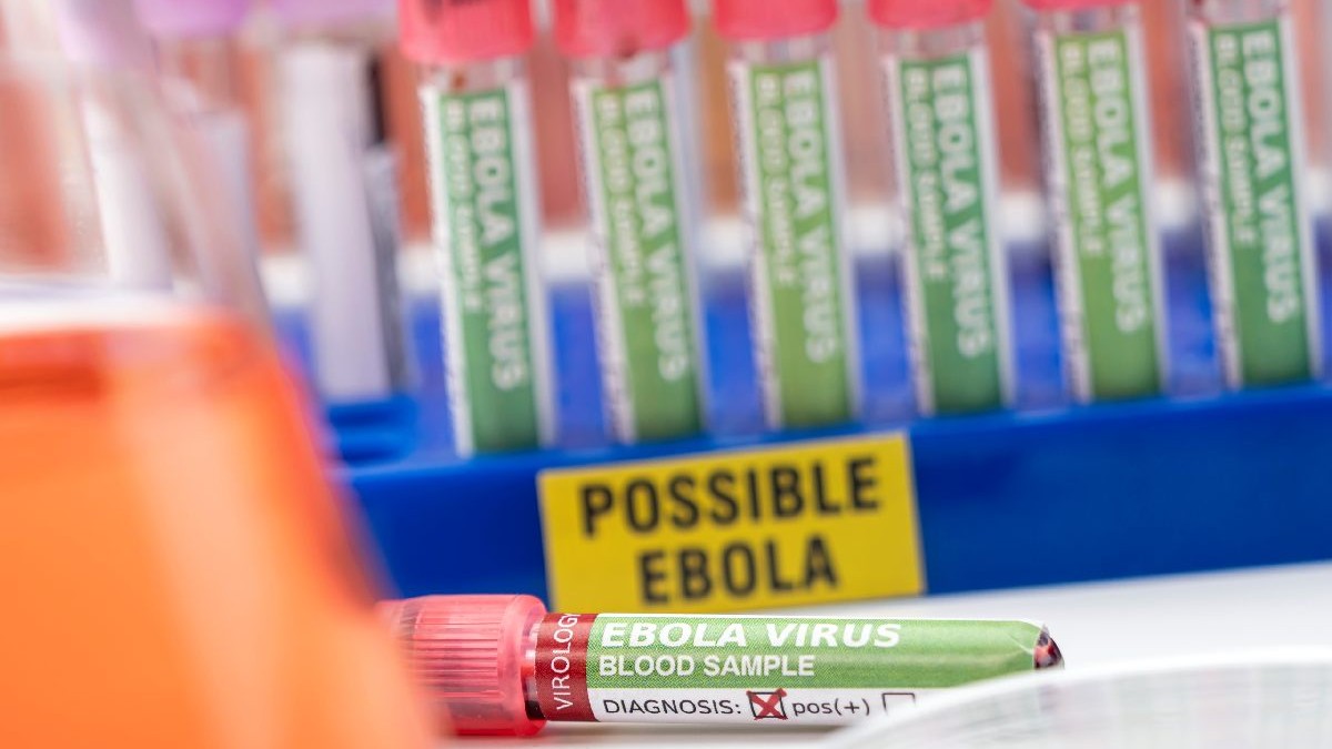 Niste eprubete pe care scrie posibil Ebola. Test pentru Ebola. Epidemie de Ebola in Congo