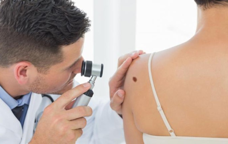 Cum poate să arate cancerul de piele! O poză devenită virală îți poate salva viața!