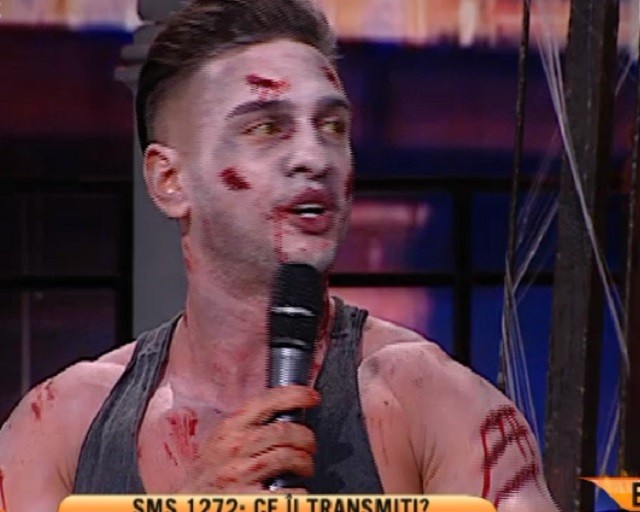 Dorian Popa, plin de răni. "M-au atacat și au vrut să..."
