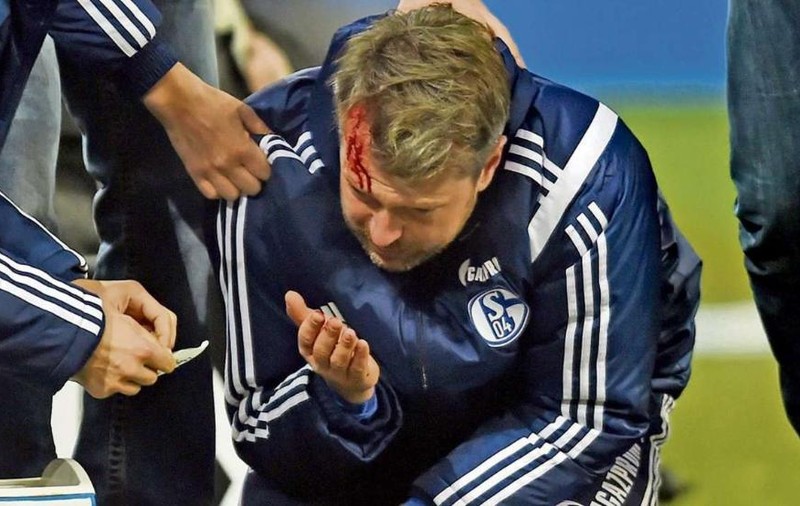 Incident sângeros în Germania. Secundul de la Schalke, lovit în cap cu o brichetă