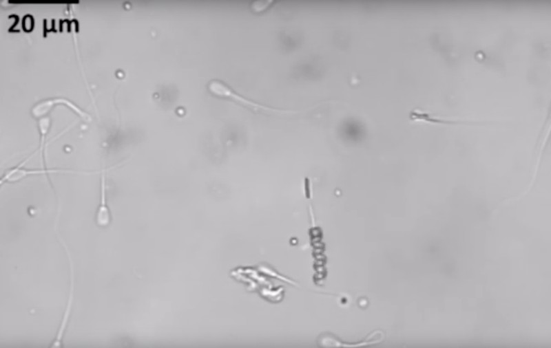 Omenirea s-ar putea confrunta cu o criză a reproducerii, din cauza scăderii numărului de spermatozoizi - studiu