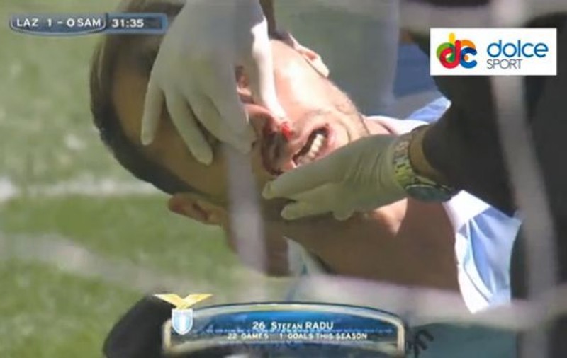 Radu Ștefan, făcut KO în meciul Lazio - Sampdoria! VIDEO