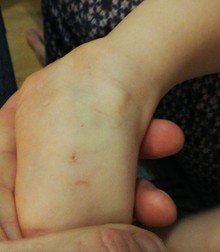 Picioruşele bebeluşului au fost "ciuruite" de ace în căutarea venei