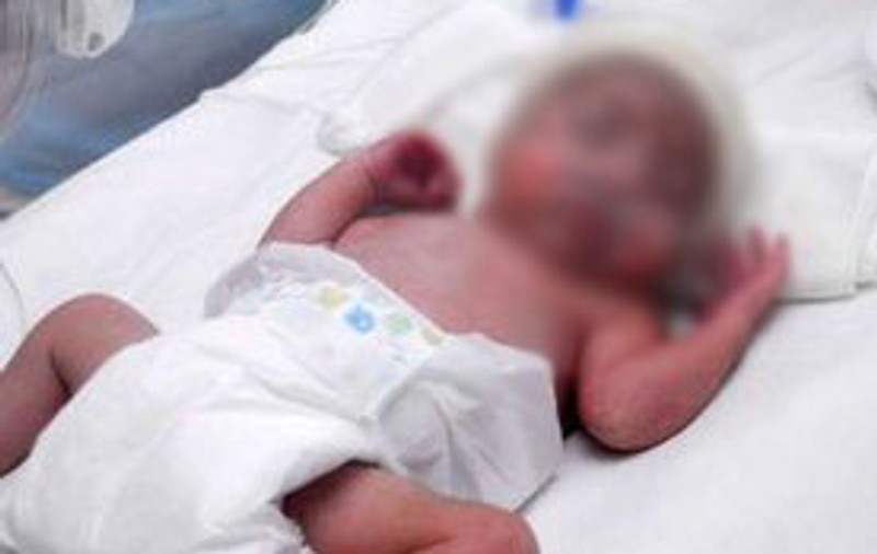 Arsuri grave pe trupul unui bebeluş lăsat în incubator