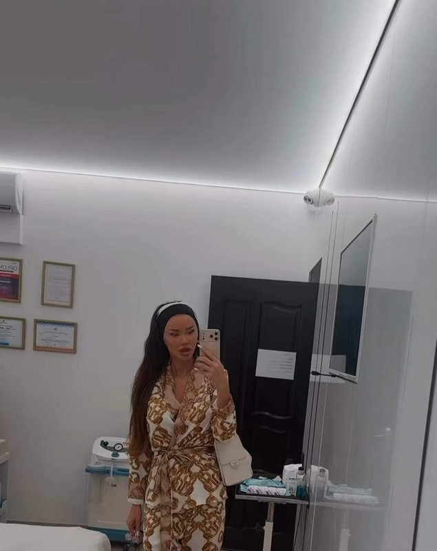 Imagini cu Bianca Drăgușanu după o nouă intervenție estetică. Are capul bandajat: „Am făcut-o și pe asta!”