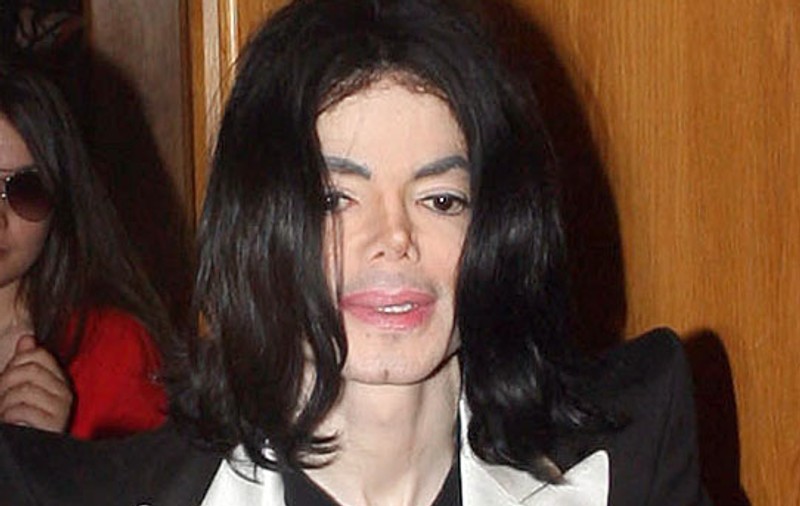 Michael se operează de cancer la piele