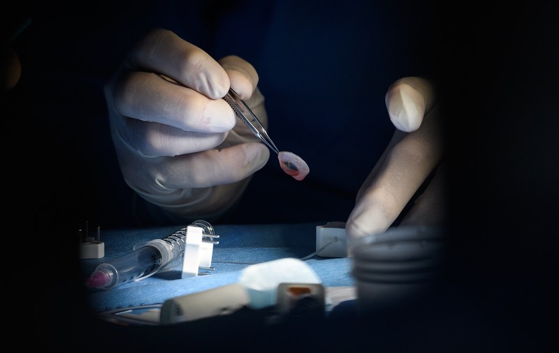A fost dezvoltat un dispozitiv care ar putea face posibil transplantul de ochi de la cadavre