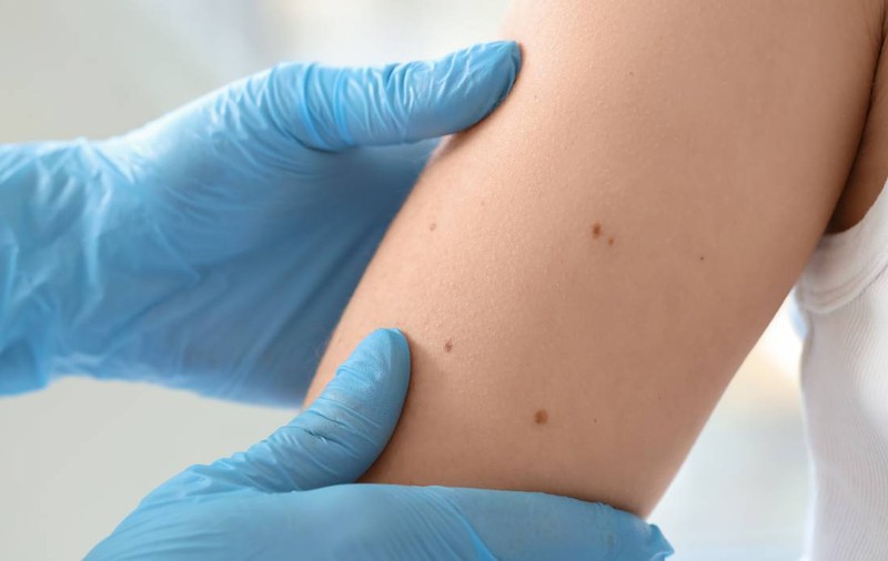 Cele mai frecvente simptome ale cancerului pe care ar trebui să le verifici. De la balonare și oboseală la pierderea vocii