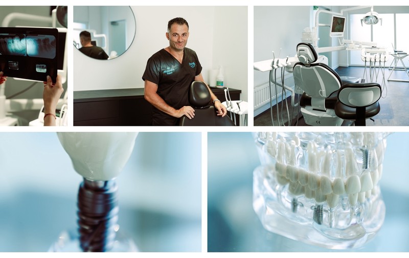 Cât costă un implant dentar și ce influențează prețul final al tratamentului?