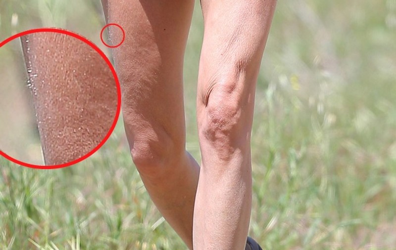 Picioare PĂROASE, SLABE şi RIDATE! O actriţă celebră arată horror fără photoshop! | FOTO