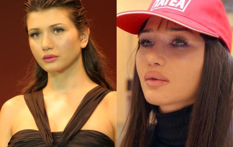 6 vedete înainte şi după mărirea buzelor. Cum arată mai bine?