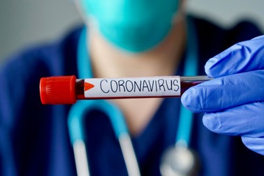 ”Noul normal”. Cum va arăta economia după pandemie. Doctor îmbrăcat în combinezon, cu stetoscop în jurul gâtului și eprubetă în mână, pe care scrie Coronavirus