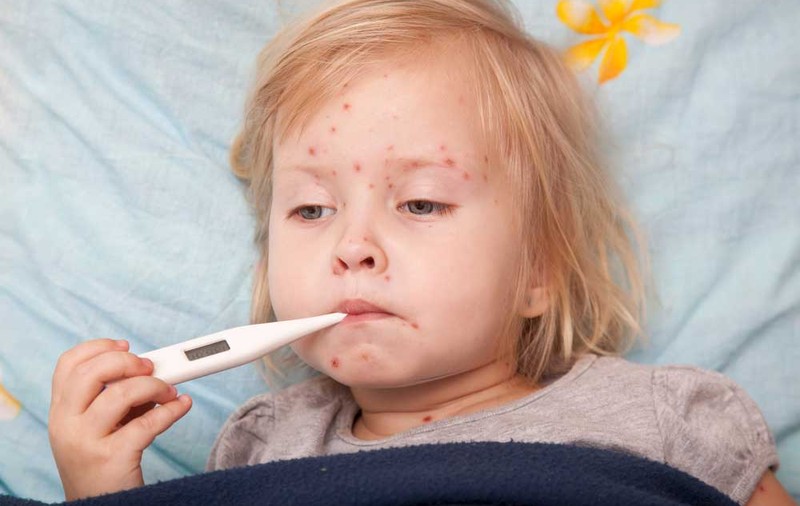 O fetiță din județul Timiș a murit din cauza rujeolei pentru că nu era vaccinată. Nouă copii au fost răpuși de boală