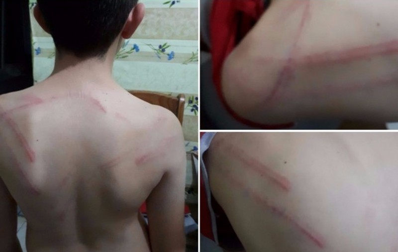 Un tată și-a bătut crunt copilul cu o nuia. A fost arestat