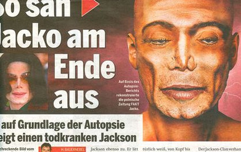 Aşa arăta Michael Jackson pe masa de autopsie?