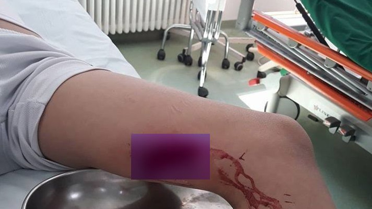 Un copil s-a rănit la un loc de joacă dezafectat, dintr-un parc din Buzău. Tatăl băiatului cere socoteală Primăriei